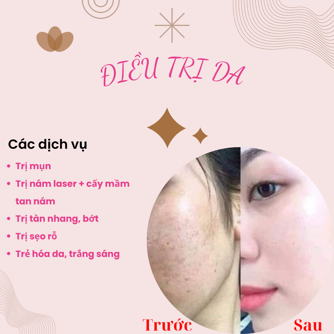 Gói chăm sóc da chuyên sâu, cơ bản